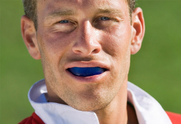Custom-Fit Mouthguards