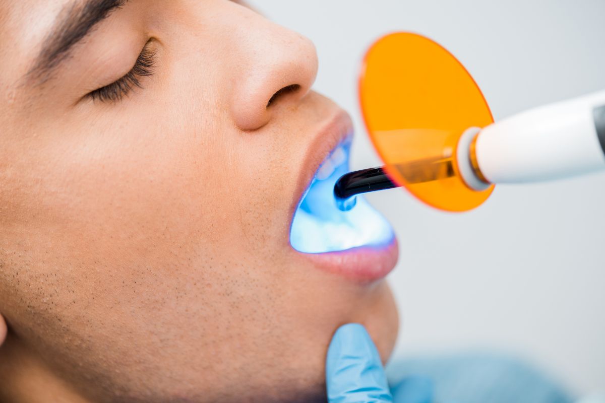 professional teeth whitening