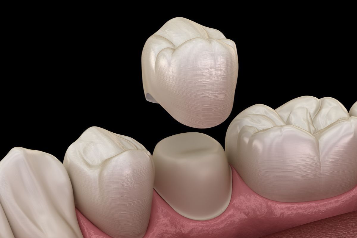 infection in dental crown